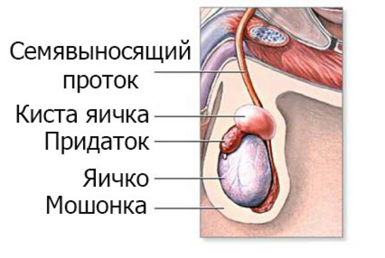 Орхит (воспаление яичек) – причины заболевания, симптомы, диагностика и лечение в Москве